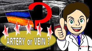 ARTERY or VEIN  USG technique [upl. by Nelson700]