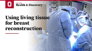 Using living tissue for breast reconstruction  Ohio State Medical Center [upl. by Atined]