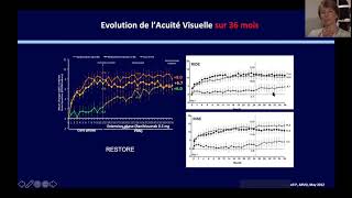 Traitement de lœdème maculaire diabétique  P Massin [upl. by Iraam]