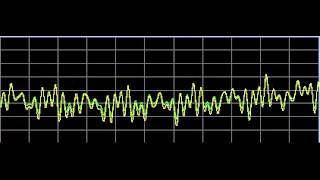 Nervous System Disorders  Rife Frequencies [upl. by Narag]