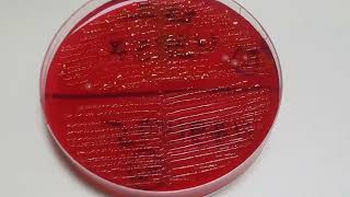 Serratia Citrobacter and Klebsiella Colony Morphology on CLED agar of Urine sample [upl. by Duwalt643]