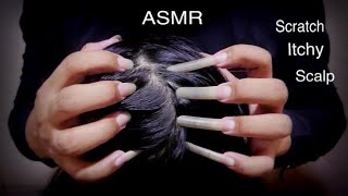 ASMR Fast Scratch itchy scalp So I Did Satisfying Scalp Scratching  No Talking [upl. by Odom]