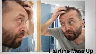 Messed Up Hairline How To Fix A Messed Up Hairline [upl. by Dorothi]