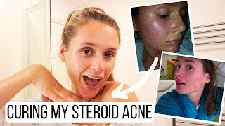 How I Cured My Steroid Acne  Natural Products  Antiinflammatory Disease [upl. by Philipa]