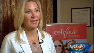 Dr Janet Allenby of Allenby Dermatology discusses the FDAcleared cellulite solution  Cellfina [upl. by Gavini]