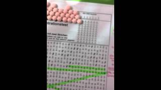 Guanfacine  Concentration Test for ADHD [upl. by Eelan]