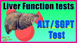 Alanine aminotransferase ALT test SGPT Alt test Results amp Interpretation  Liver function test [upl. by Euqirne393]