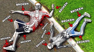 We Broke EVERY BONE in GTA 5 RP Mods [upl. by Naillik]