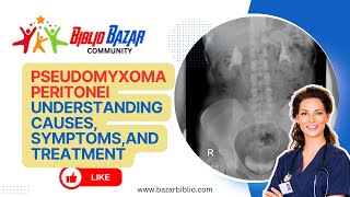 Pseudomyxoma Peritonei Explained Symptoms Treatment and Care 🏥  Rare Abdominal Condition [upl. by Laon552]