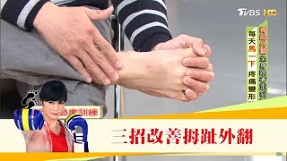 腰痛查不出原因，竟是「拇指外翻」造成的！三招改善讓腳不變形 健康20 [upl. by Drye859]