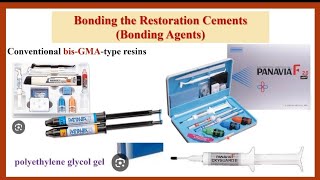 Bonding Steps of ResinBonded FDP بالعربي [upl. by Yelekreb464]