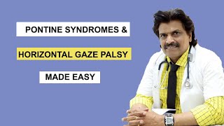 PONTINE SYNDROMES amp HORIZONTAL GAZE PALSY MADE EASY [upl. by Hpesoy]