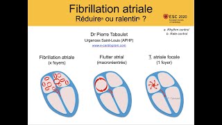 5g Fibrillation atriale ralentir ou cardioverser ESC 2020  ECG Dr Taboulet [upl. by Hahnert]