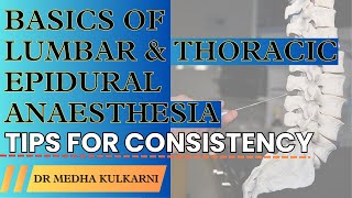 Mastering Epidural Anesthesia Essential Tips for Consistency I Dr Medha Kulkarni [upl. by Gerardo992]