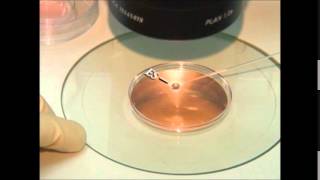 vitrification of embryos and oocytes [upl. by Ja]