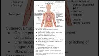 Signs and symptoms of anaphylaxis [upl. by Aihsenot]