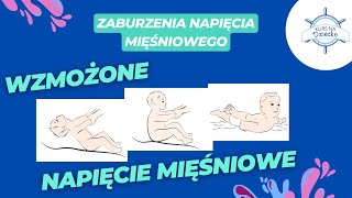 WZMOŻONE Napięcie mięśniowe 💪❓ ODBIERZ ZNIŻKĘ 5 ✅ kursnadziecko [upl. by Atekram768]