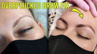 My Secret Weapon for Fixing Overplucked Thin Brows One Time Treatment [upl. by Bernelle637]