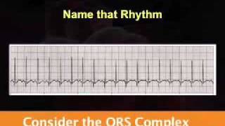 Introduction to EKG Rhythm Interpretation Part 2 [upl. by Maryly]