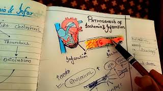 pathogenesis of ischemia and infarction NGMedicals [upl. by Raimes61]