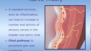 Understanding Interstitial Cystitis ICPainful Bladder Syndrome PBS [upl. by Atteuqram333]