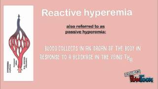 hyperemia [upl. by Boleslaw]