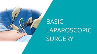 Basic Laparoscopic Surgery [upl. by Yeleen]