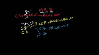 Nerve Root vs Peripheral Nerve 2 of 2 motor complaints upper extremity [upl. by Ainsley]