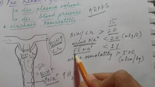 ACUTE KIDNEY INJURY  Prerenal Intrinsic renal and Postrenal azotemia  USMLE STEP 1 [upl. by Aynna]