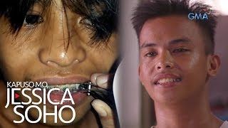 Kapuso Mo Jessica Soho Peligrosong DIY braces [upl. by Ainslee]