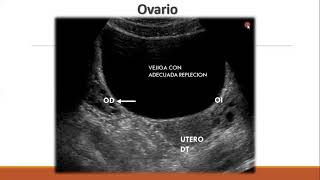 ULTRASONIDO PELVICO PARTE II [upl. by Madian]