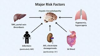 Hepatic Encephalopathy [upl. by Llednyl]