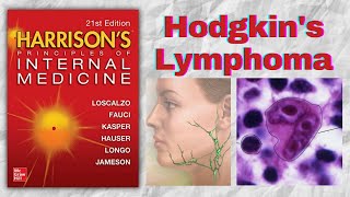 HODGKINS LYMPHOMA  Presentation  Diagnosis  Staging  Treatment  Harrison [upl. by Oregolac744]