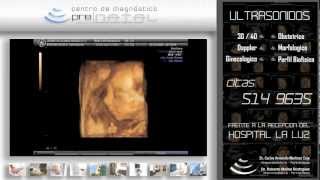 Centro de diagnostico prenatal hospital la luzmov [upl. by Konstantin]