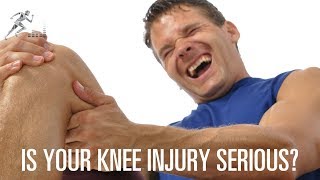 How to know if you have a serious knee injury [upl. by Llenrup]