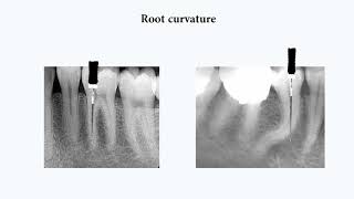 Endodontics from A to Z series 1Basics [upl. by Inalaehon235]