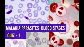 Malaria Parasites Blood stages Identification Training  Quiz 1 [upl. by Attesor]