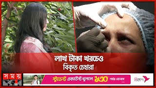 বোটক্স তারুণ্য ধরে রাখতে গিয়ে এখন মুখ দেখানোই দায়  Botox Injections  Botulinum Toxin  Somoy TV [upl. by Lukasz]