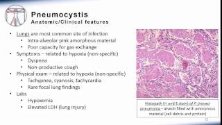 5 Pneumonia Pneumocystis [upl. by Rovert]