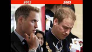 Prince Williams beauty before  after Kate in pictures [upl. by Nikal]