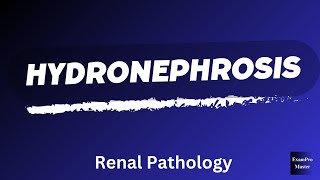 Hydronephrosis  Renal Pathology  Robbins  Easy Explanation [upl. by Bouldon621]