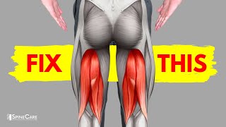 How to Fix a Tight Hamstring for Good [upl. by Nirroc723]