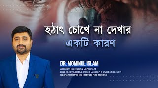 Cause of Eye Vision Loss হঠাৎ চোখে না দেখার একটি কারণ [upl. by Etnahsa]