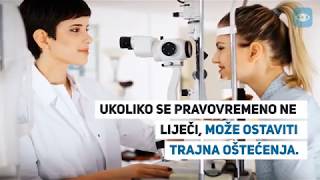 Konjunktivitis  uzroci i simptomi upale [upl. by Romona]