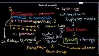 Bacterial meningitis [upl. by Filomena]