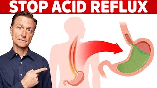 Top 5 Vitamins To Stop Acid Reflux Permanently [upl. by Anoirb]