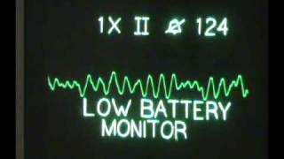 ACLS Algorithms  Ventricular Fibrillation  Sacramento Class [upl. by Ailbert]