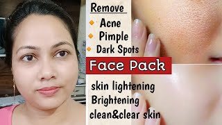 3 Days Challenge for Glowing amp Brightening Skin  Home made Face Pack for Skin whitening  Face Mask [upl. by Esinahs269]