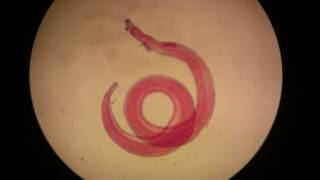 Adult male of Schistosoma haematobium [upl. by Williamsen]