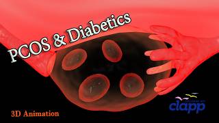 PCOS AND DIABETICS  3D Animation [upl. by Acisej]